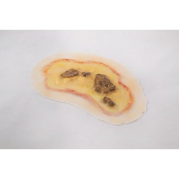 Moulage Science & Training Large Ulcer, Mannequin MST-45-01-01